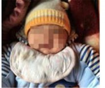 <strong>母亲失手杀害2岁儿子 撞墙男童的复</strong>