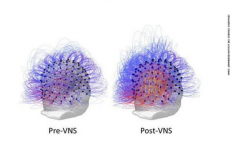 科学家利用刺激神经唤醒沉睡15年植 科学家利用刺激神经唤醒沉睡15年植